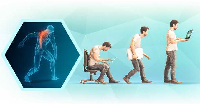 zła postawa podczas pracy przy komputerze i osteochondroza klatki piersiowej